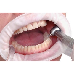 OptraGate ExtraSoft Lip and Cheek Retractors (Ivoclar)