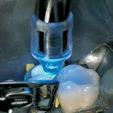 FOCU TIP Intensifying Tip 8mm (2) (Hager)