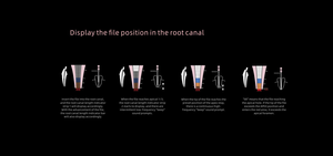 Woodpex V Apex Locator