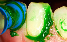 Kolorz Prophy Paste 200 (DMG)