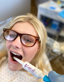 Capt-all Amalgam Separator Capture HVE Tip (Dove Dental)