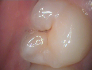 CamX Elara IntraOral Camera