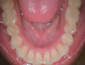 CamX Elara IntraOral Camera