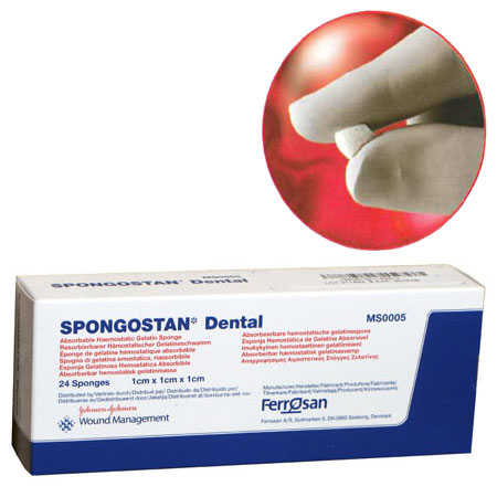 Spongostan Absorbable Hemostatic Gelatin Sponge, 1cm x 1cm x 1cm, Sterile 24/Bx Spongostan Absorbable Hemostatic Gelatin Sponge, 1cm x 1cm x 1cm, Sterile 24/Bx