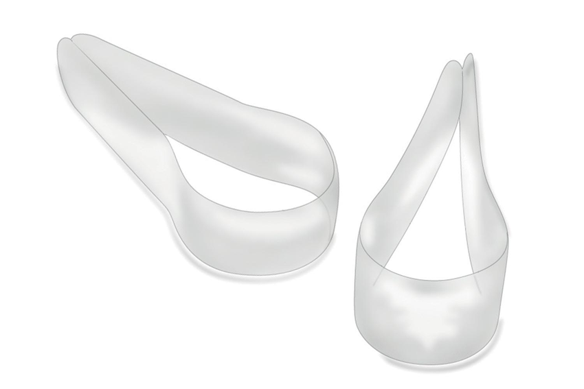 Tofflemire Contoured Transparent Matrices (Polydentia)