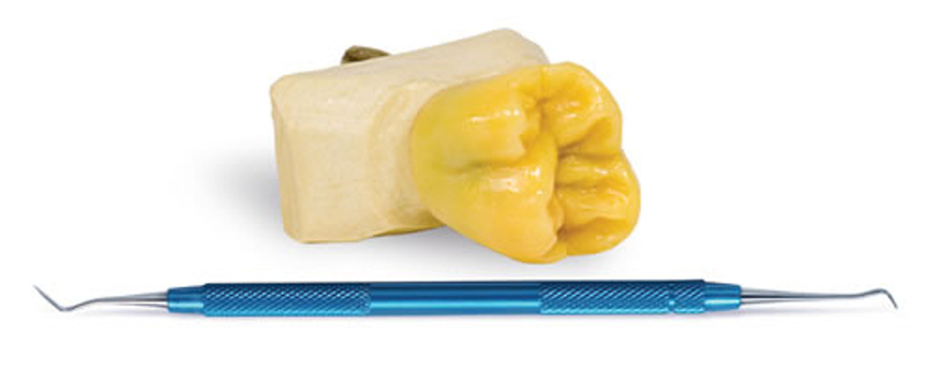 Wax Carver WC-1 (Hollenbeck/Cleoid) Aluminum Handle Stainless Steel Tips Wax Carver WC-1 (Hollenbeck/Cleoid) Aluminum Handle Stainless Steel Tips