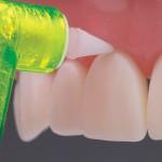 2Pro Angles (Premier)