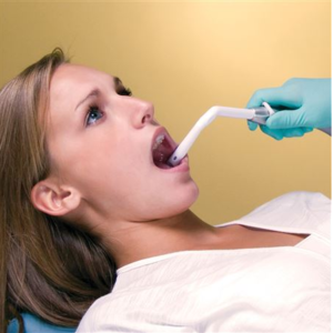 Angle-Ease HVE Tips 50/Pkg