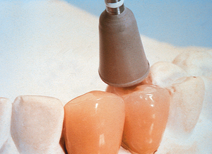 CeraMiste CA (Shofu)