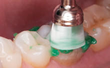 Kolorz Prophy Paste 200 (DMG)