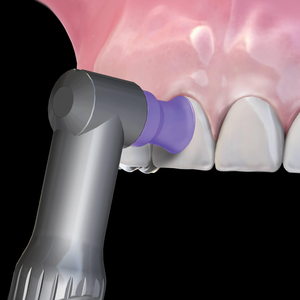 DPA Contra Prophy Angles (Hu Friedy)