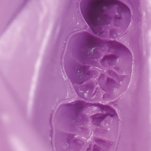 Hydrogum 5 Fast Set (453g Bag)