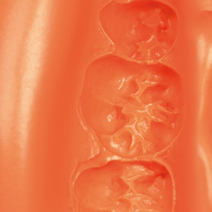 Neocolloid Alginate Regular Set (500g Bag)