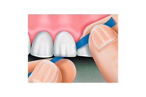 Tria-Shine (Polydentia)