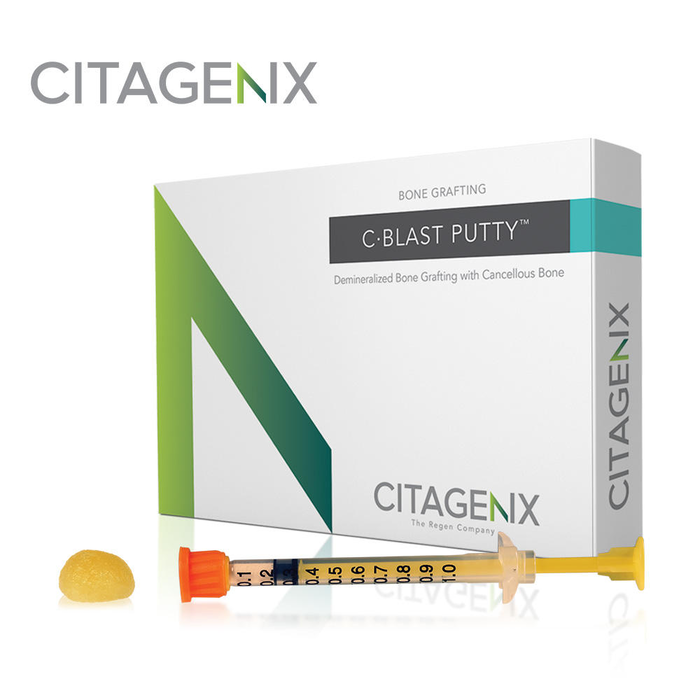 C Blast Putty With Cancellous Particles (Citagenix) C Blast Putty With Cancellous Particles (Citagenix)