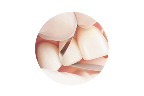 Two Striper Diamond Finishing Strips (Premier) Two Striper Diamond Finishing Strips (Premier)