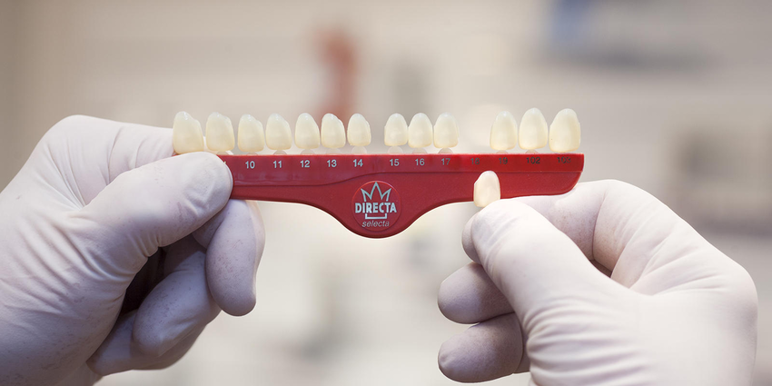 Directa Poly Crown Mould Guide 