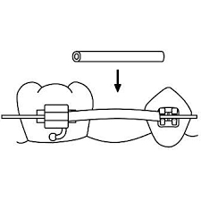 Tissue Guard .018 10' Spool Non Latex